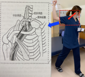 どめ（右腕が麻痺してます） どめ（右腕が麻痺してます） 腕の神経麻痺について【よくある症状】